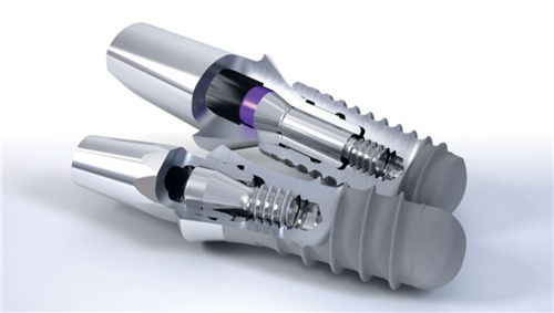 Straumann implant.jpg Straumann implant.jpg